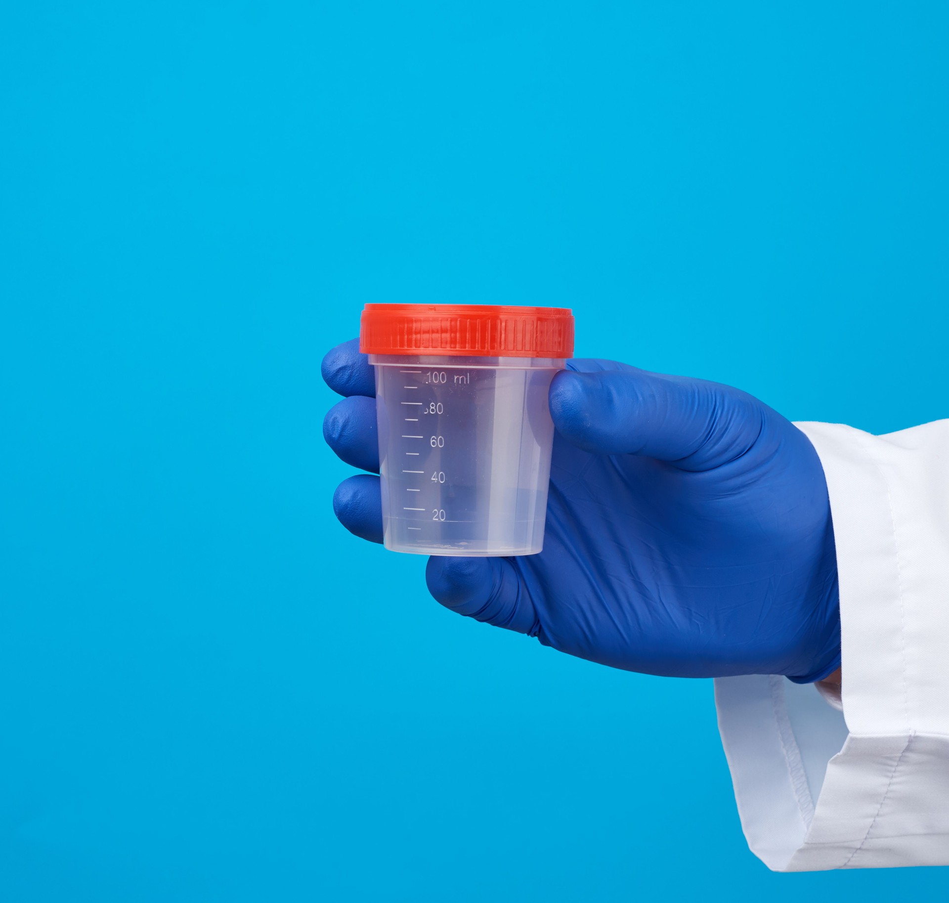 male doctor in a white coat holds a empty plastic container for urine specimen